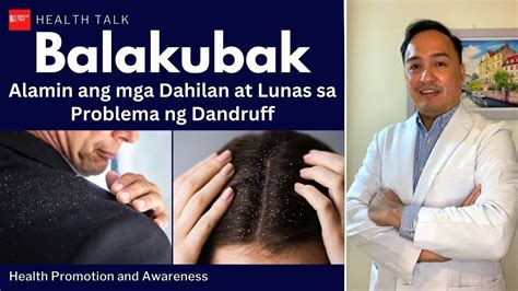 balakubak sa bulbol ni rastaman|Balakubak (Dandruff) .
